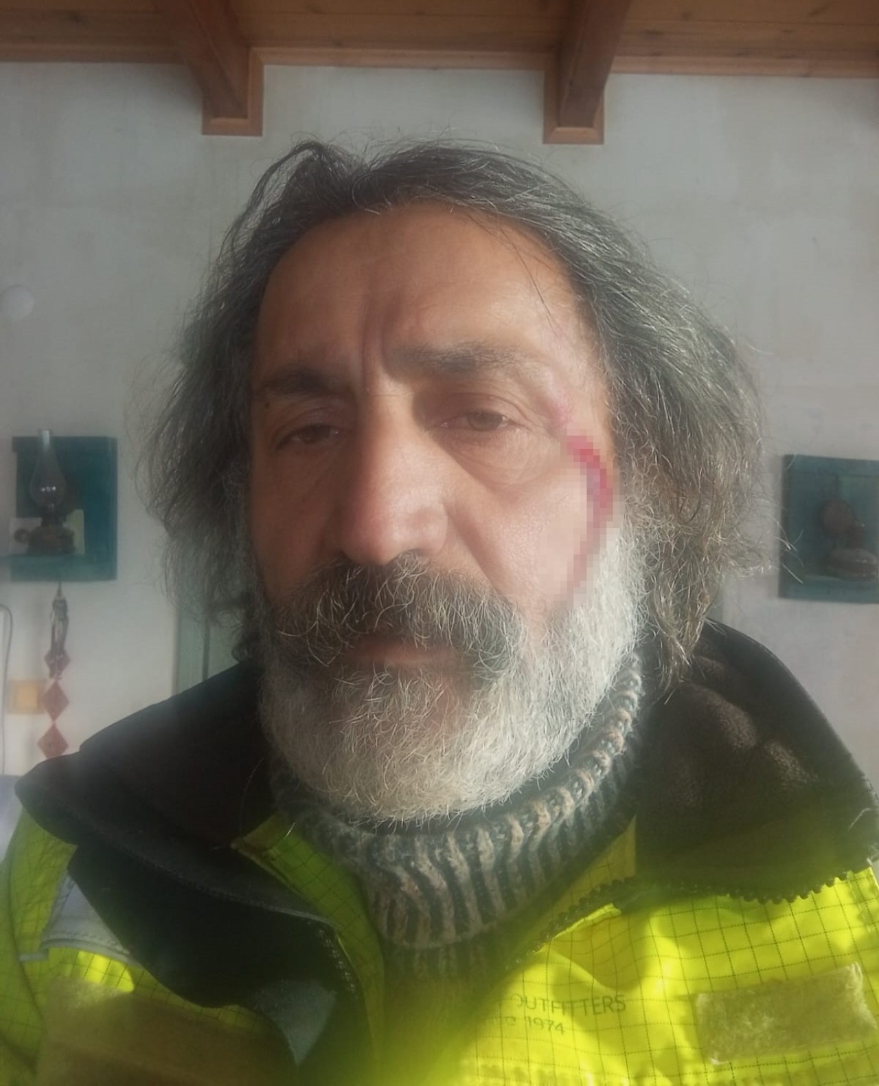 Erzurum İspir’de Kurt Saldırısına Uğrayan Vatandaş Köpeklerinin Yardımıyla Kurtuldu