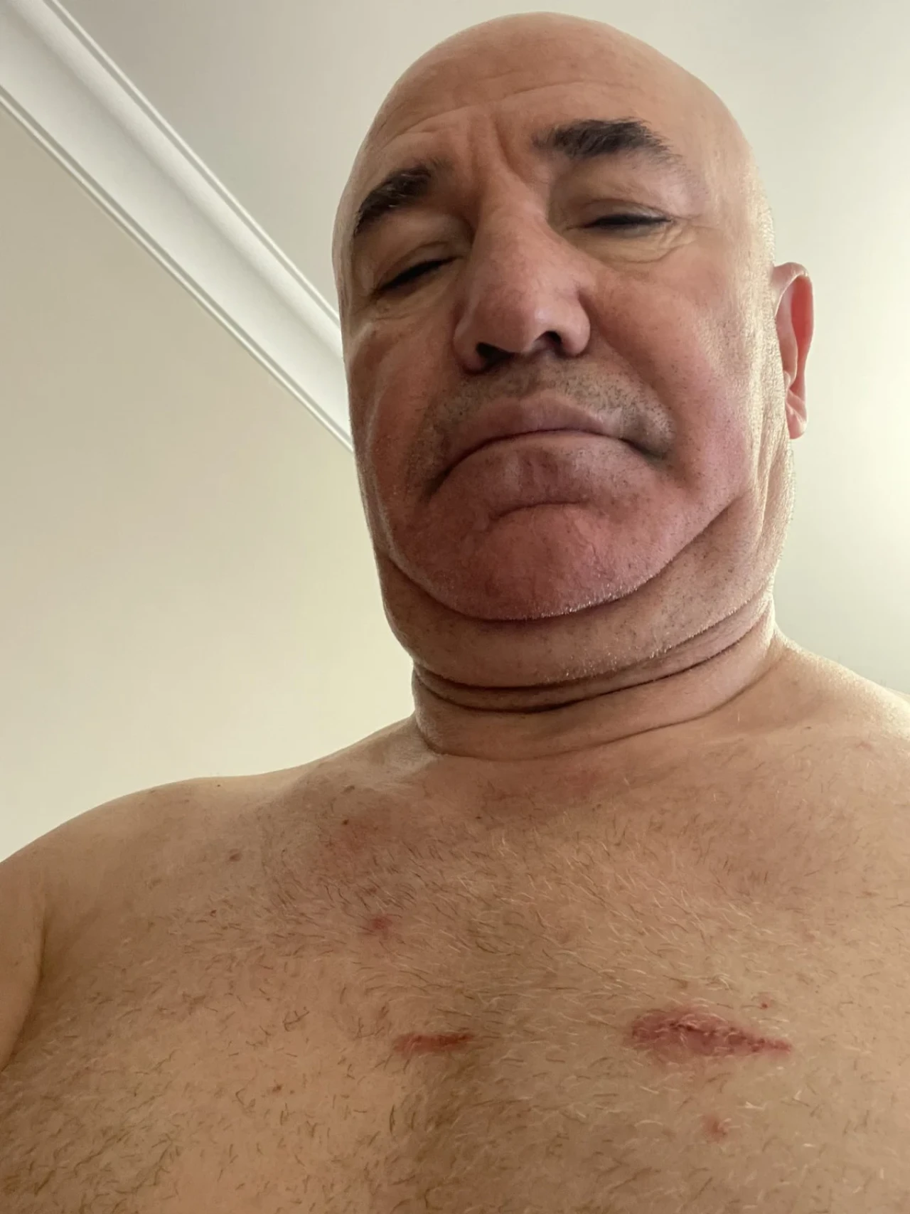 Saraçhane'de Gergin Protesto: CHP Milletvekili Yarı Çıplak Fotoğraf Paylaştı