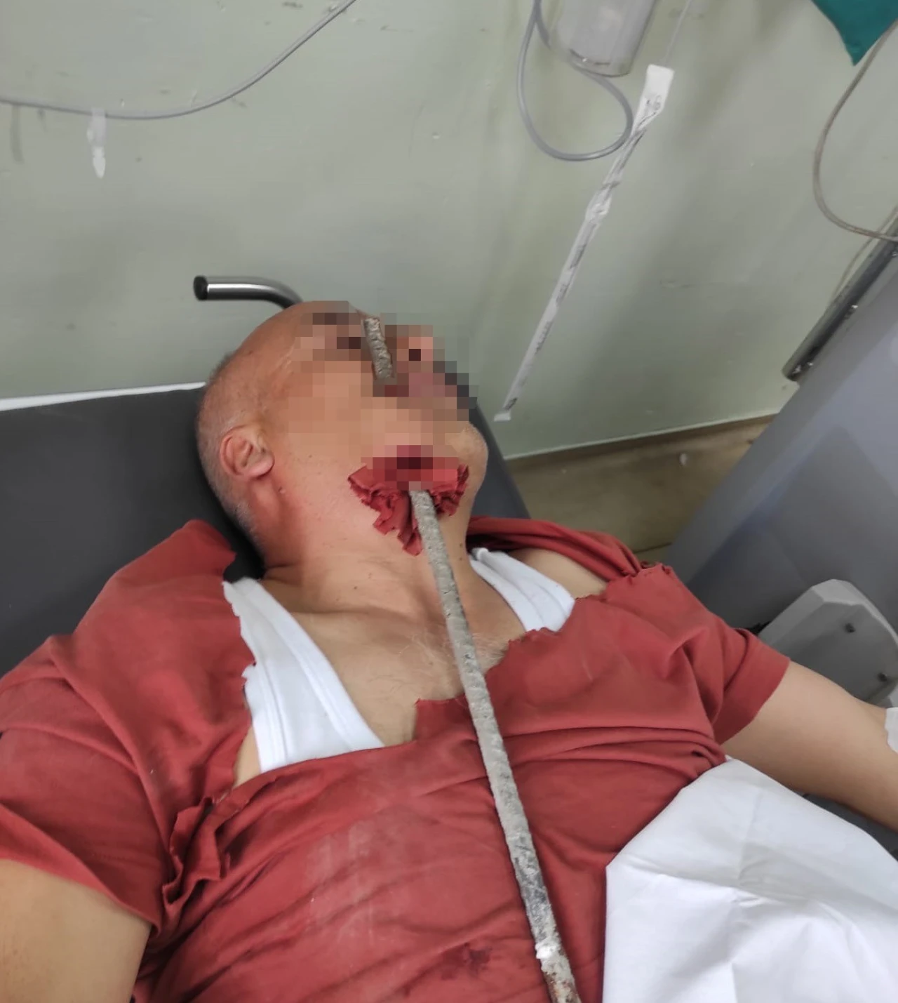 Hatay’da Dehşet! İşçinin Yüzüne Demir Saplandı