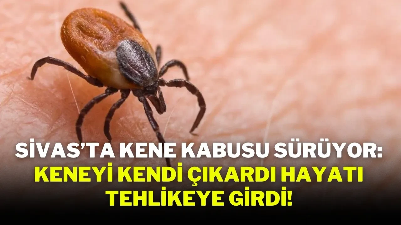 Sivas’ta Kene Kabusu Sürüyor: Keneyi Kendi Çıkardı Hayatı Tehlikeye Girdi!