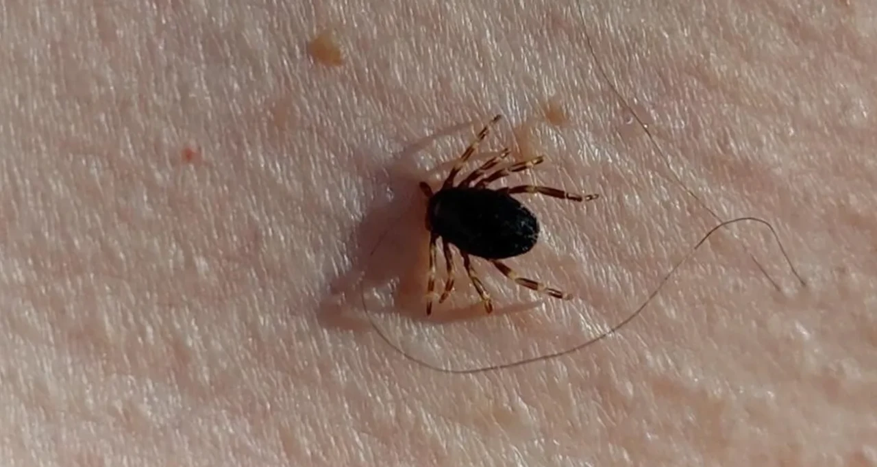 Kene Isırığı Bir Canı Daha Aldı