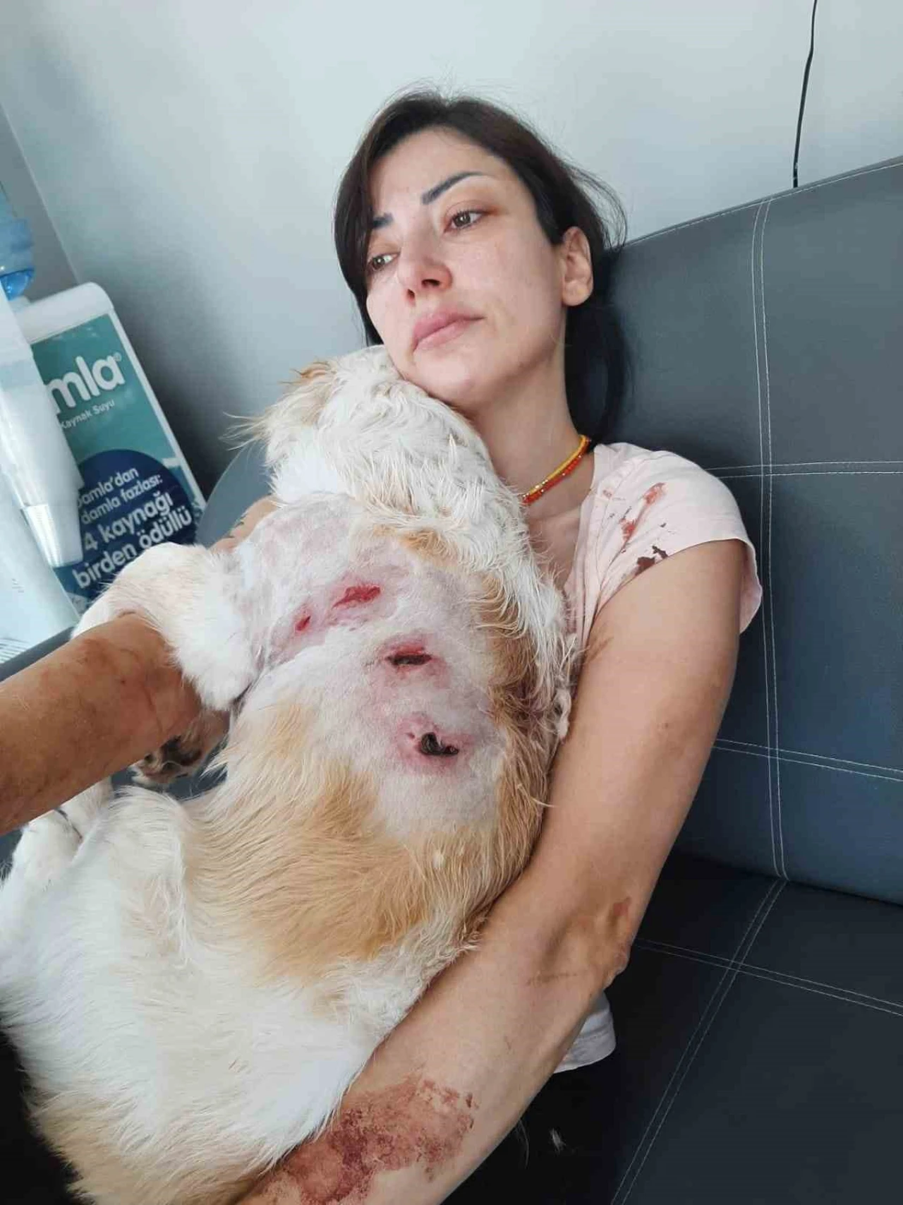 Bursa’da Kangal Köpeklerinin Saldırısına Uğrayan Kadın ve Köpeği Yaralandı