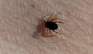 Kene Isırığı Bir Canı Daha Aldı