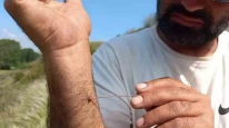 Kene Uyarısı: “Vücutta Ne Kadar Uzun Kalırsa Risk O Kadar Artar”