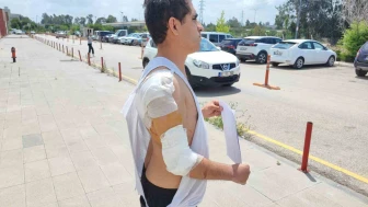 Hastane Yolunda Kurt Köpeği Saldırısı: Yaralandı