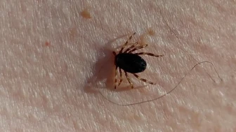 Kene Isırığı Bir Canı Daha Aldı