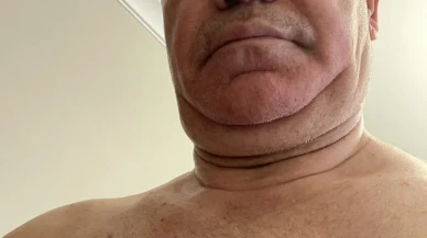Saraçhane'de Gergin Protesto: CHP Milletvekili Yarı Çıplak Fotoğraf Paylaştı